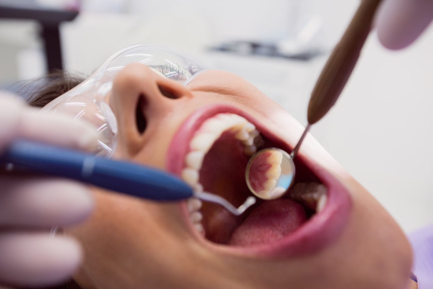 Cuidados después de una endodoncia: alimentos, medicamentos y recomendaciones clave